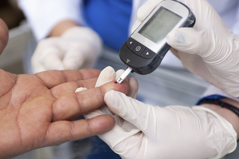 Esame del sangue per determinare la concentrazione di glucosio nel plasma a digiuno per diagnosticare il diabete
